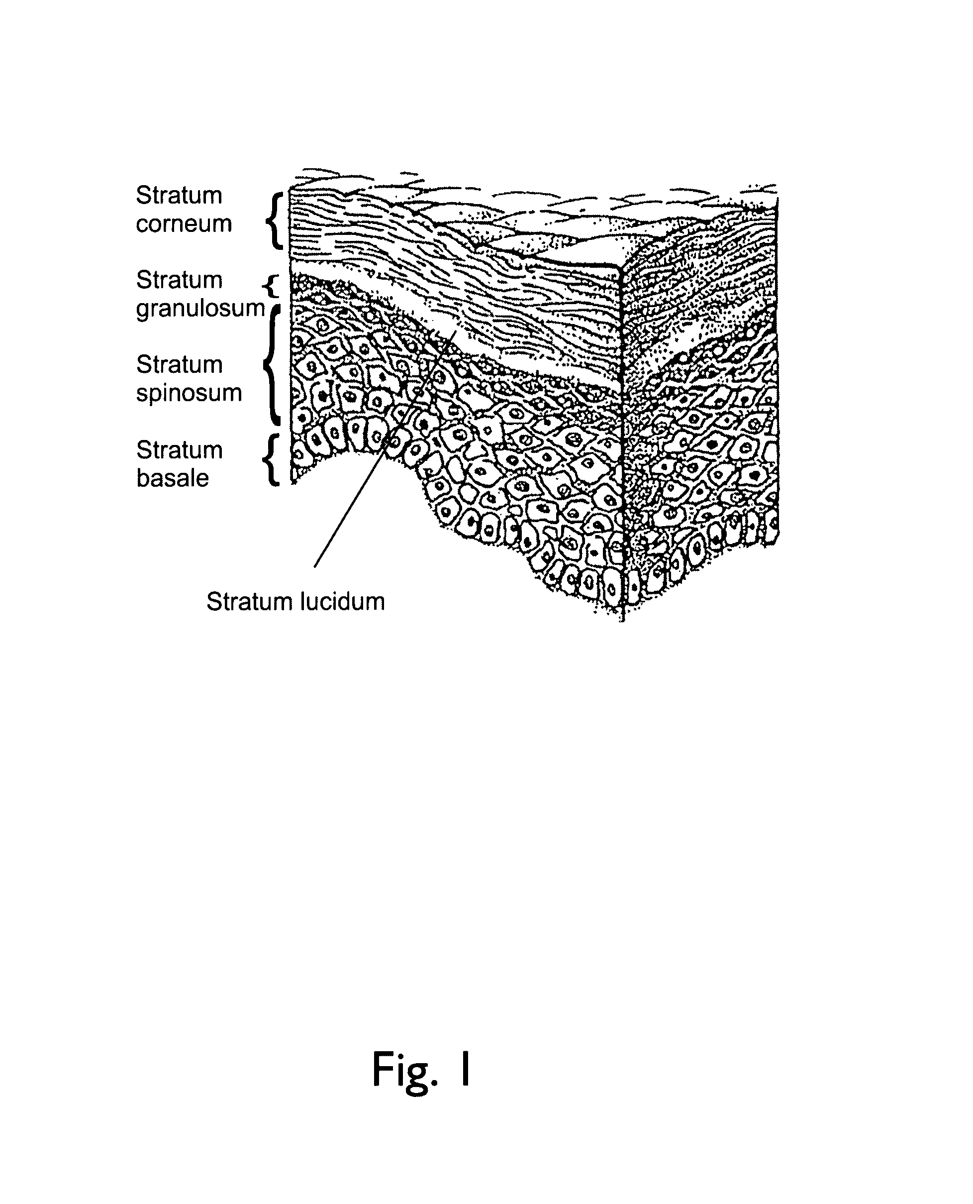 Physiological recording device or electrode