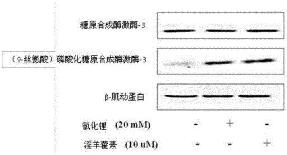 Application of icariin in the preparation of drugs for preventing and treating Alzheimer's disease