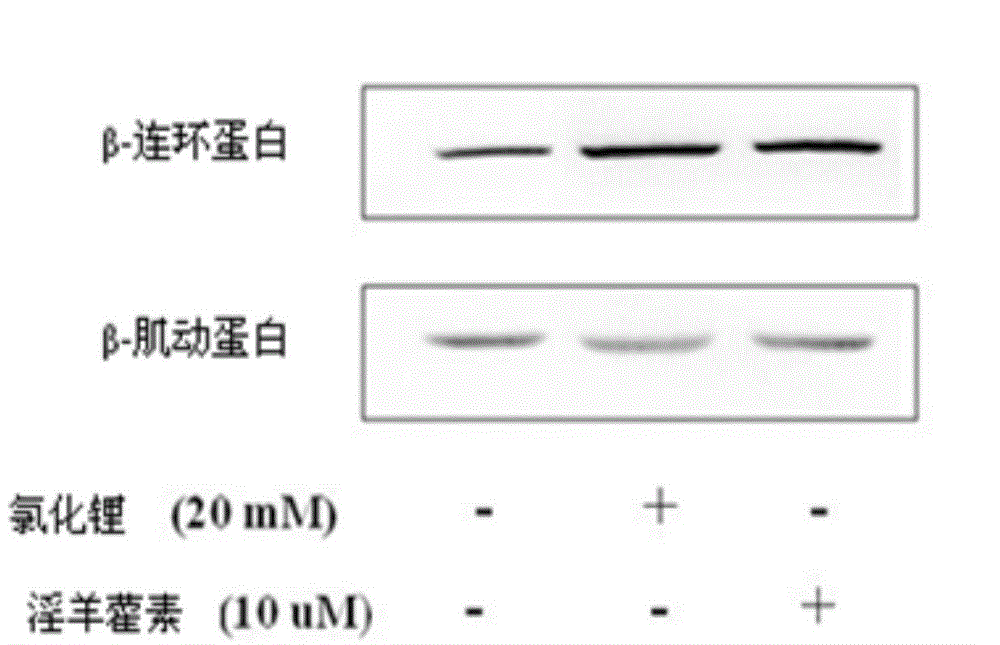 Application of icariin in the preparation of drugs for preventing and treating Alzheimer's disease