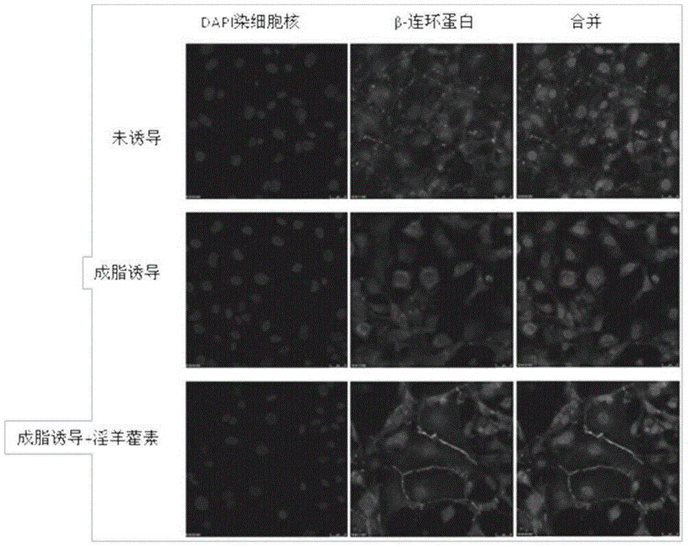 Application of icariin in the preparation of drugs for preventing and treating Alzheimer's disease