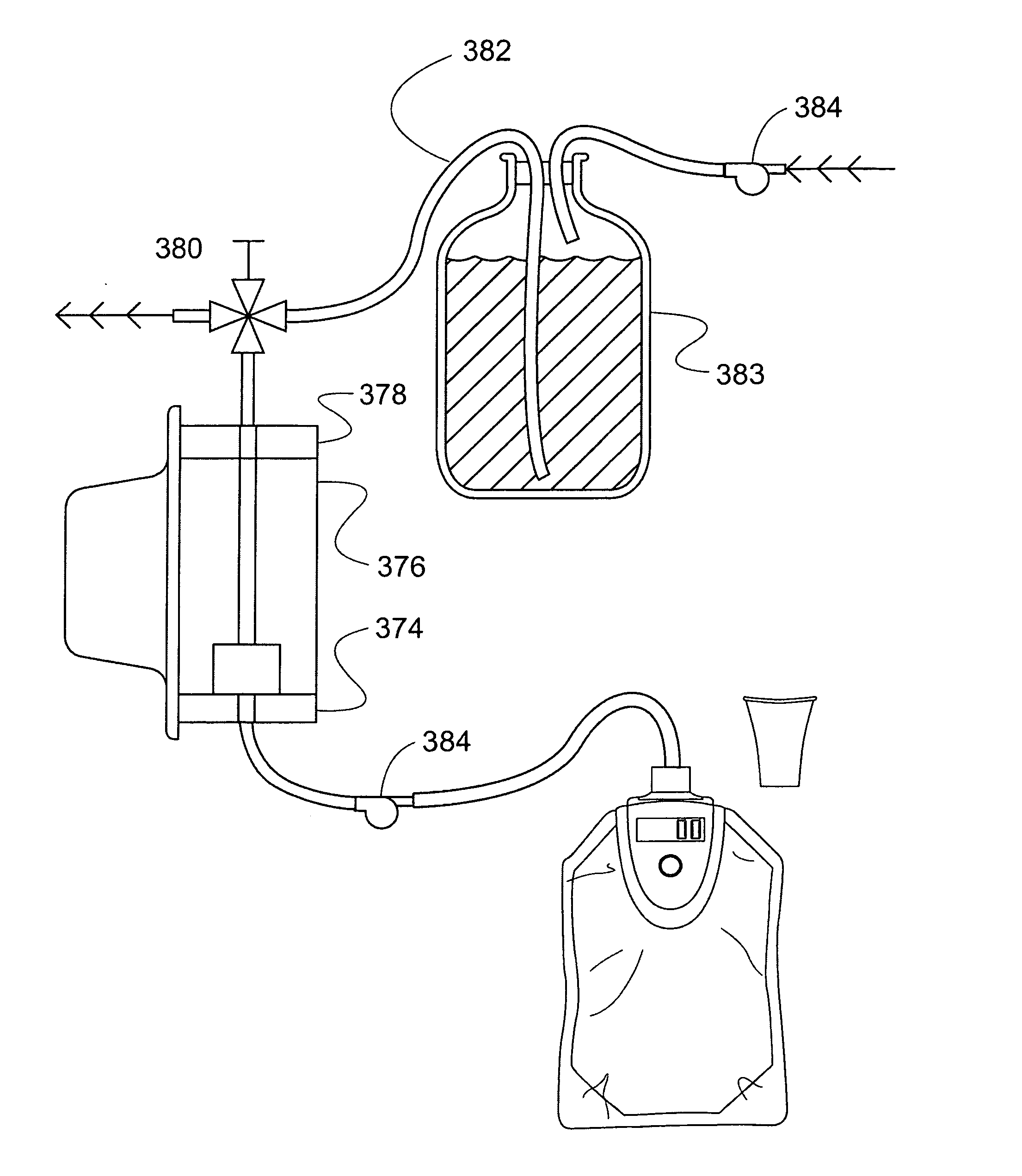 Method and apparatus for analyzing acetone in breath