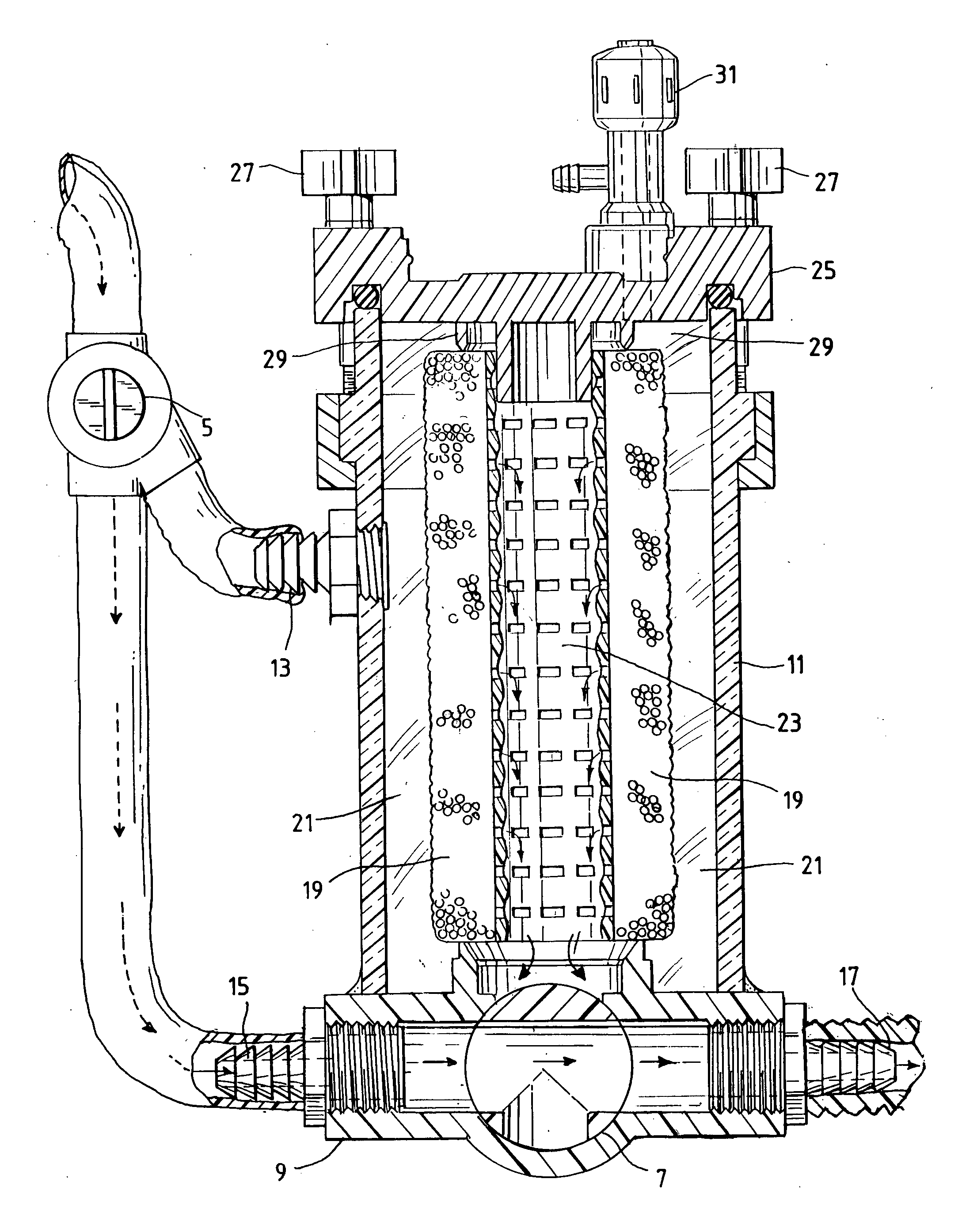 Method and apparatus for removing particulate metals from dental waste water