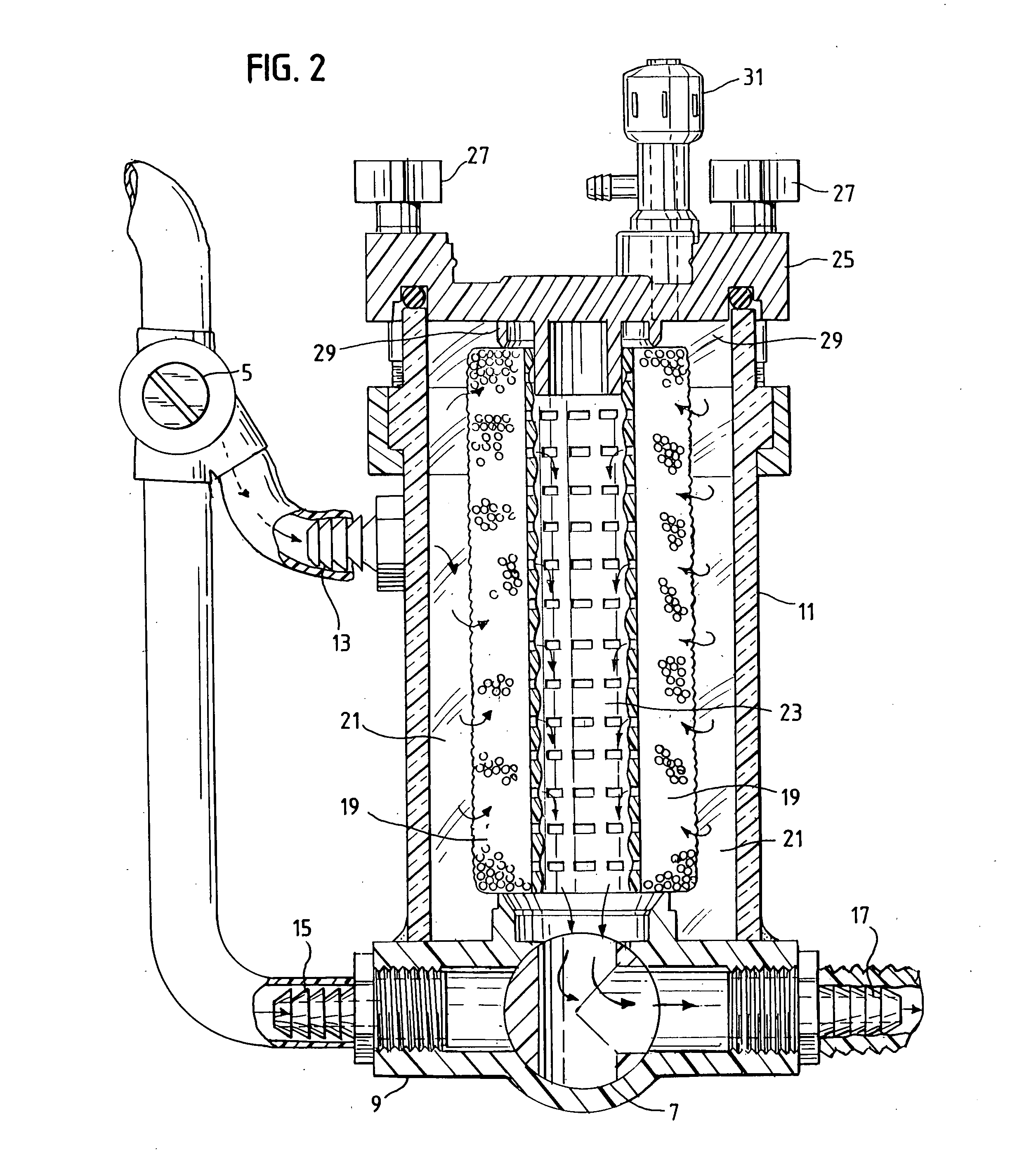 Method and apparatus for removing particulate metals from dental waste water
