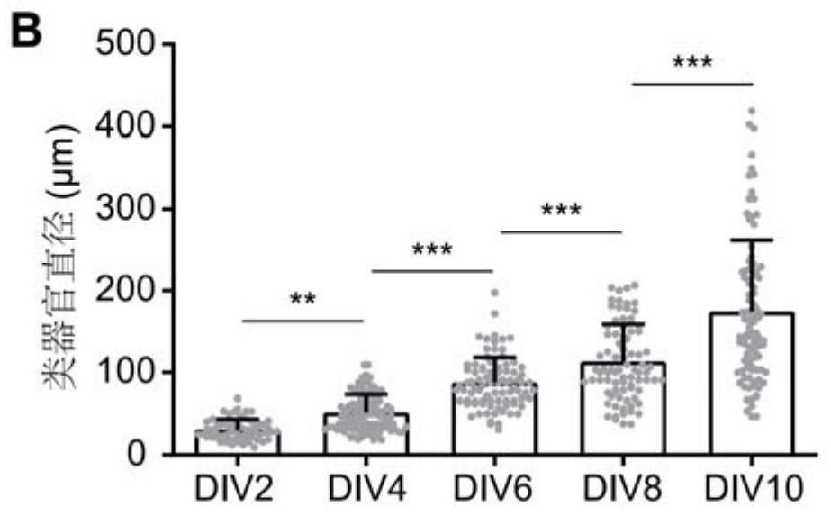 A composition for promoting hair cell regeneration and hearing restoration and its application