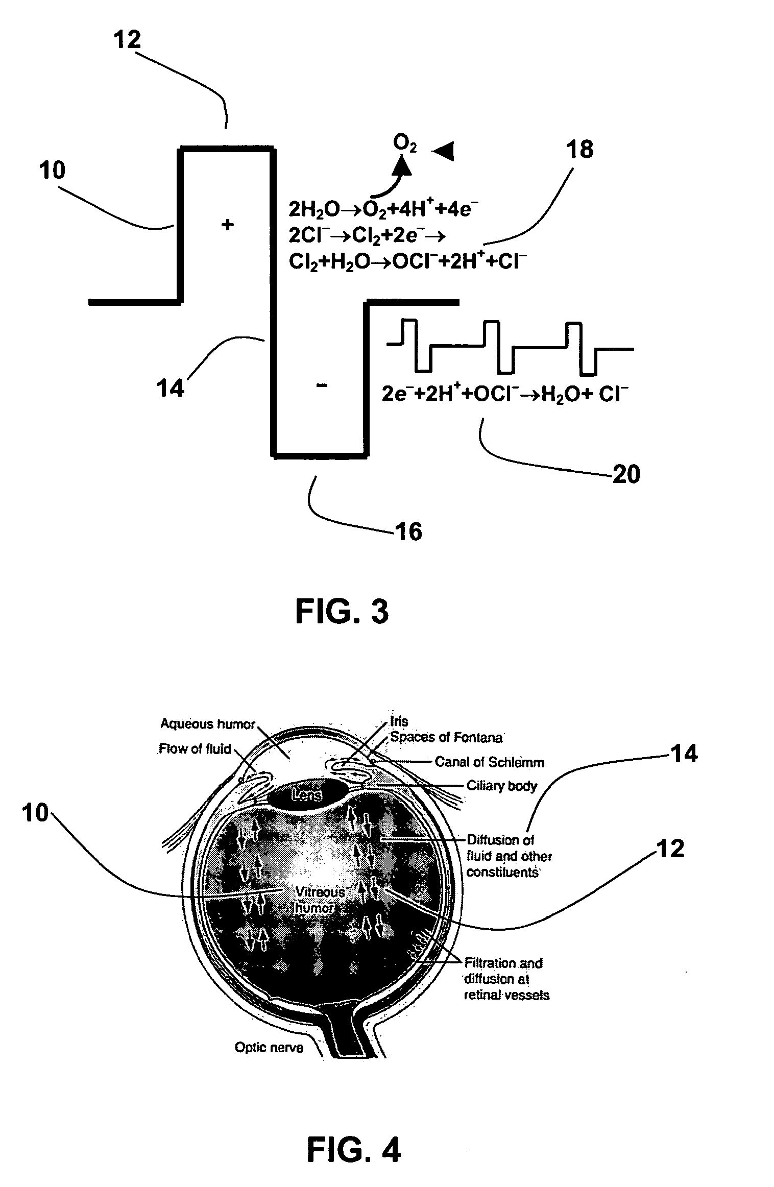 Method and apparatus for treating ischemic diseases