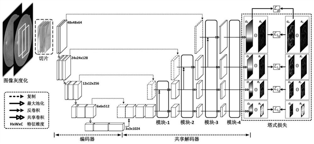 Vessel Segmentation Method of Fundus Image Based on Shared Decoder and Residual Tower Structure