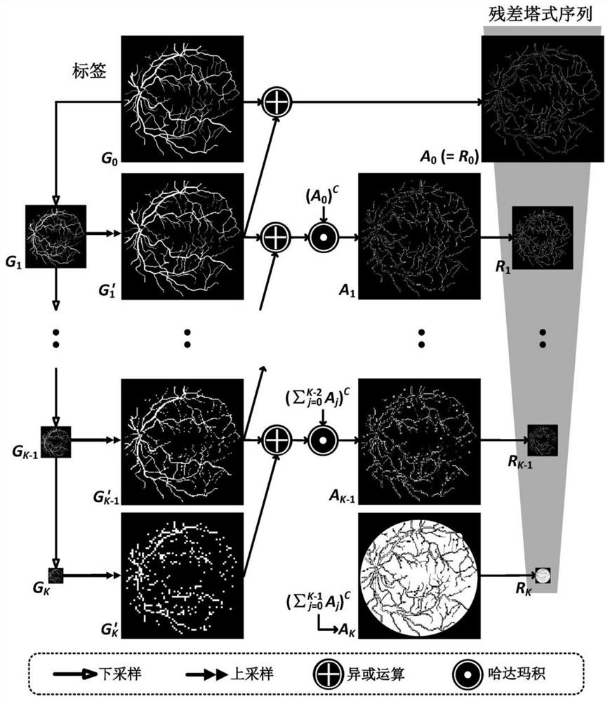 Vessel Segmentation Method of Fundus Image Based on Shared Decoder and Residual Tower Structure