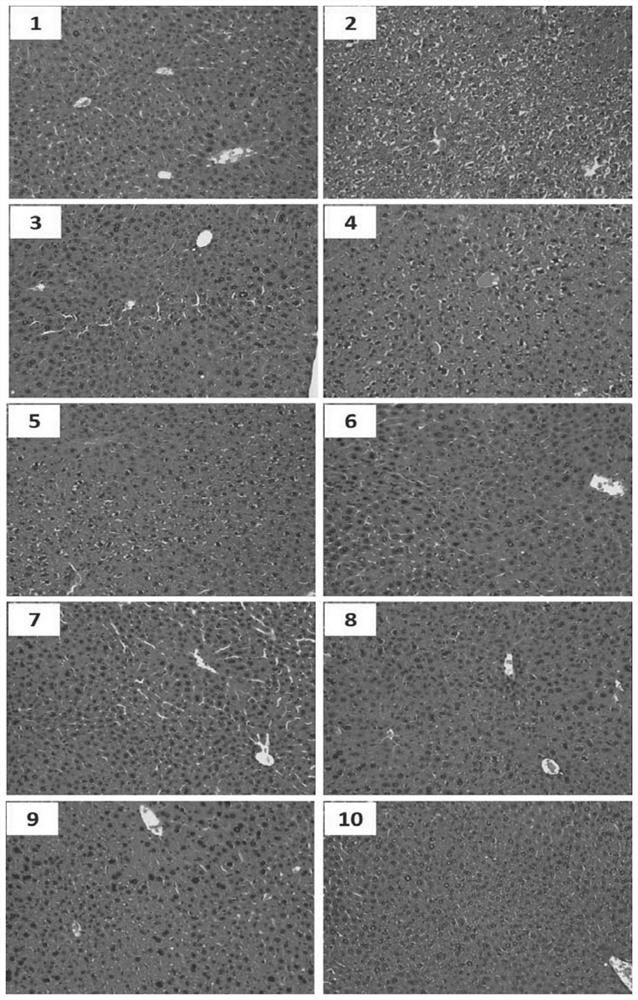 A ginsenoside composition capable of preventing and treating alcoholic fatty liver