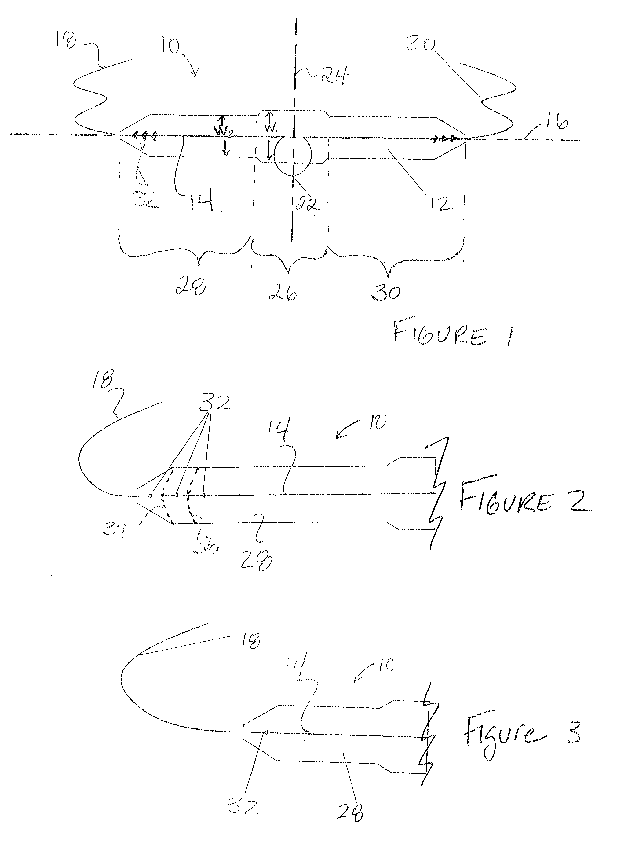 Apparatus and method for the treatment of stress urinary incontinence