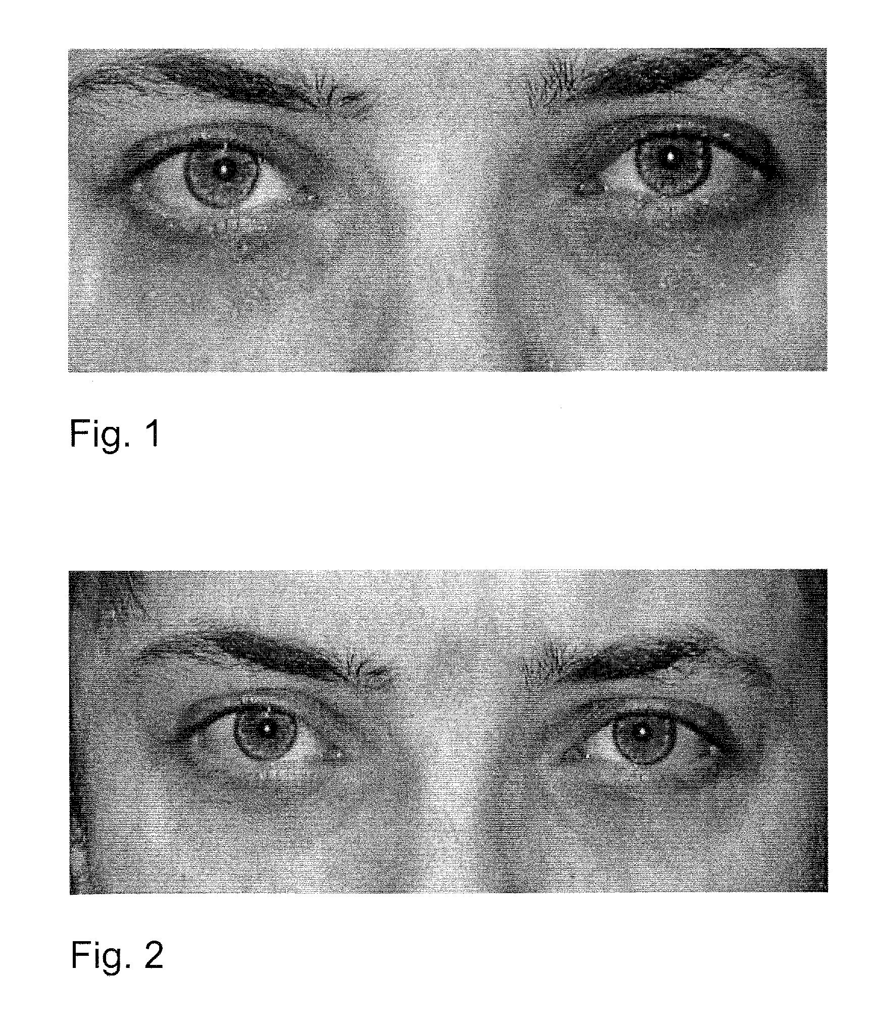 Compositions and methods of using same for treatment of a disease or disorder of the eye and/or the adnexa of the eye