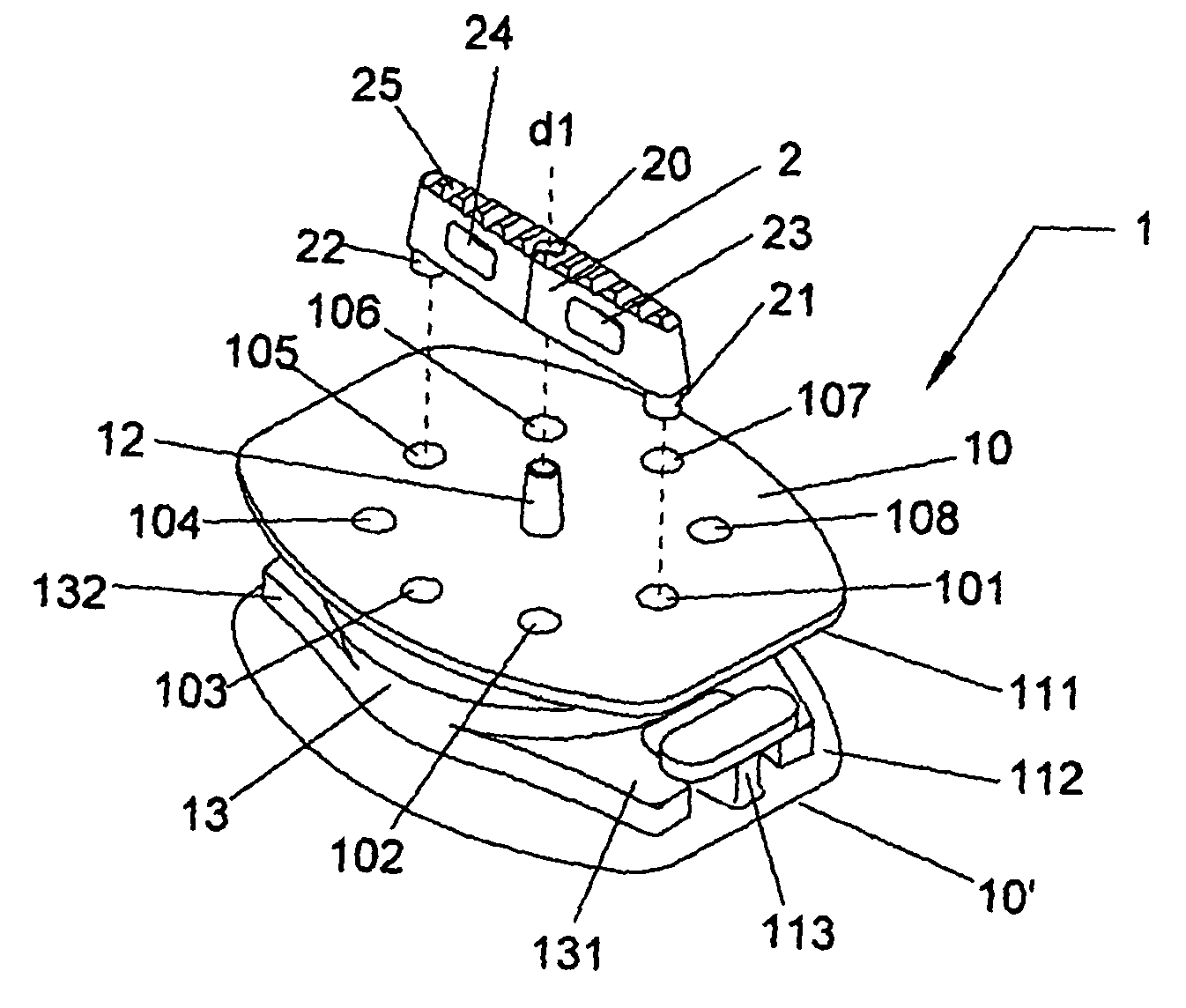 Osseous achoring device for a prosthesis