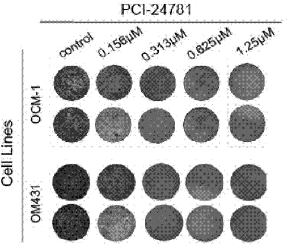 Application of pan-HDAC inhibitor to preparation of drug used for treating uveal melanoma