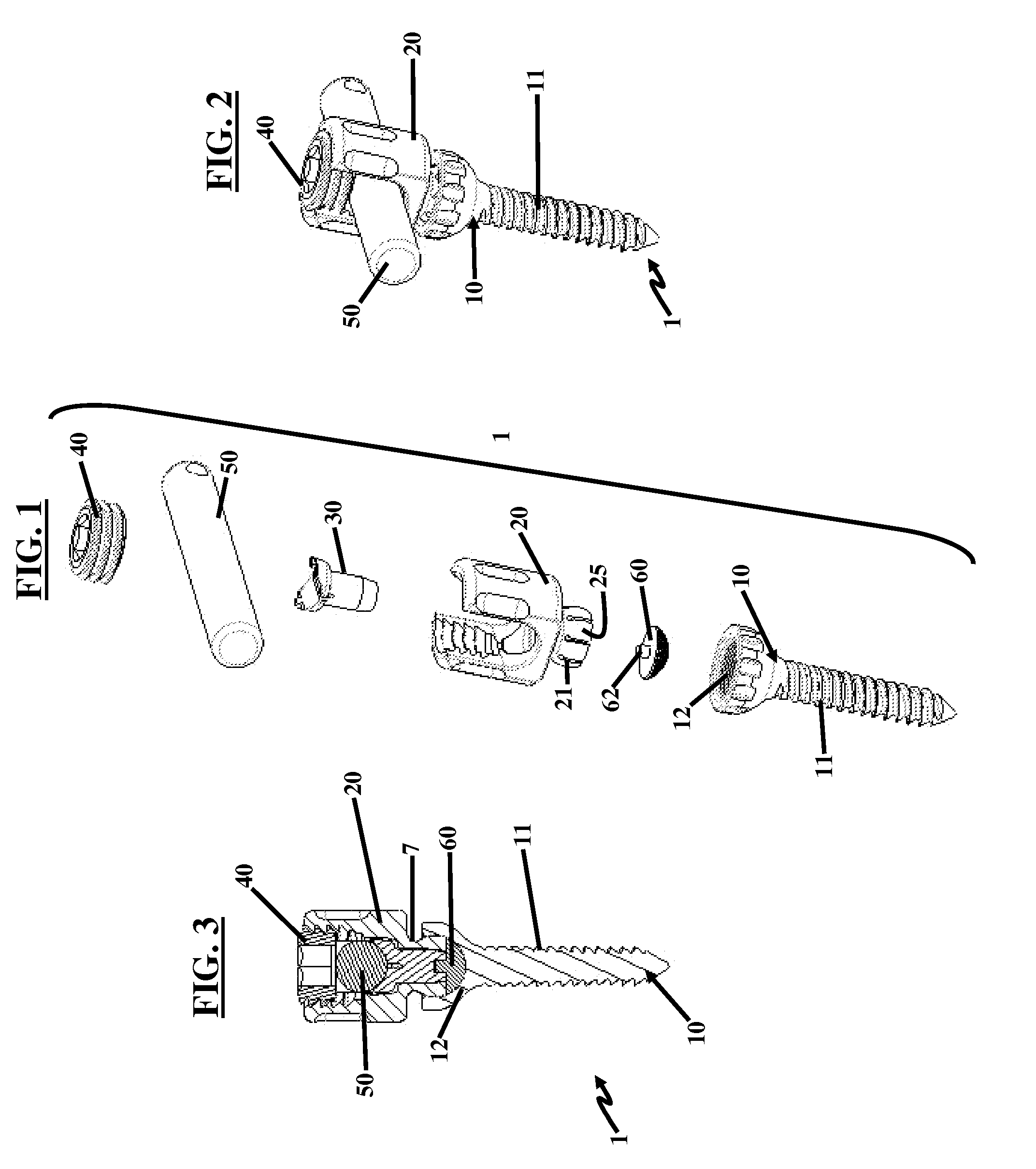 Screw Assembly and Method