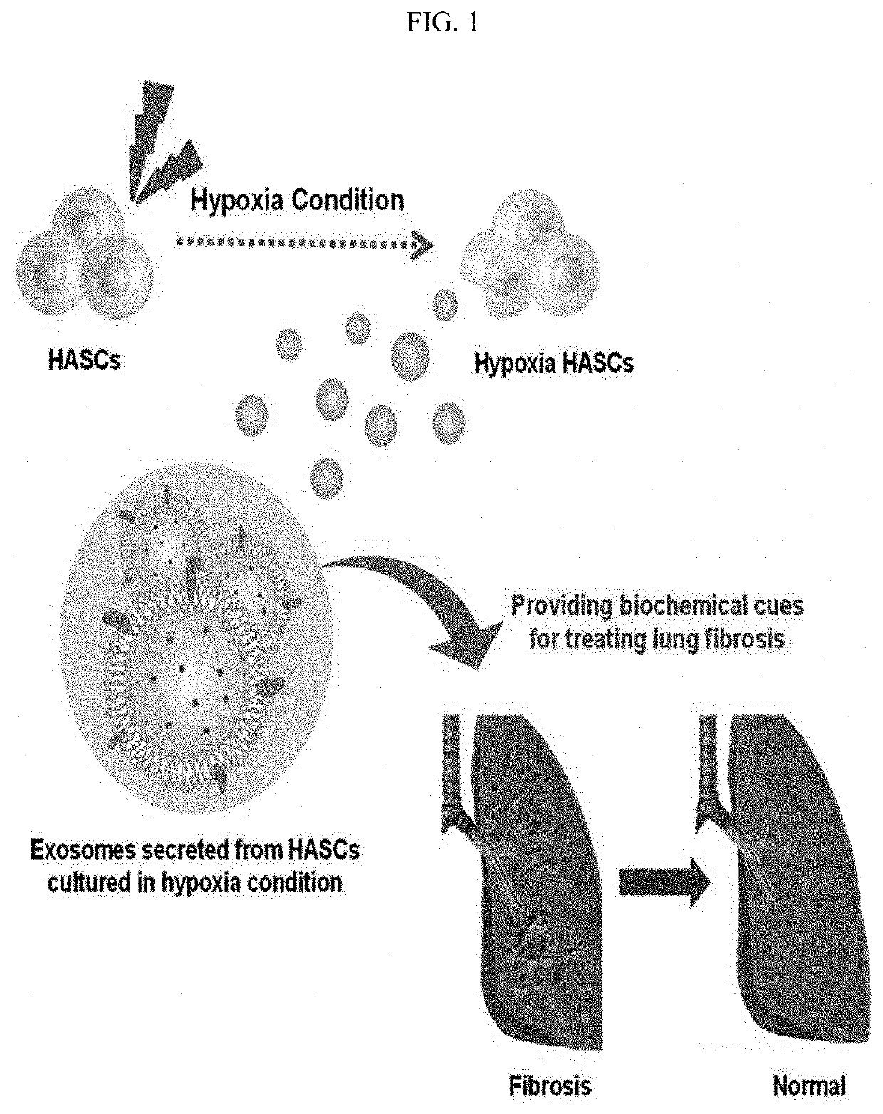 Composition for preventing or treating pulmonary fibrosis containing exosome isolated from adipose-derived stem cell as active ingredient