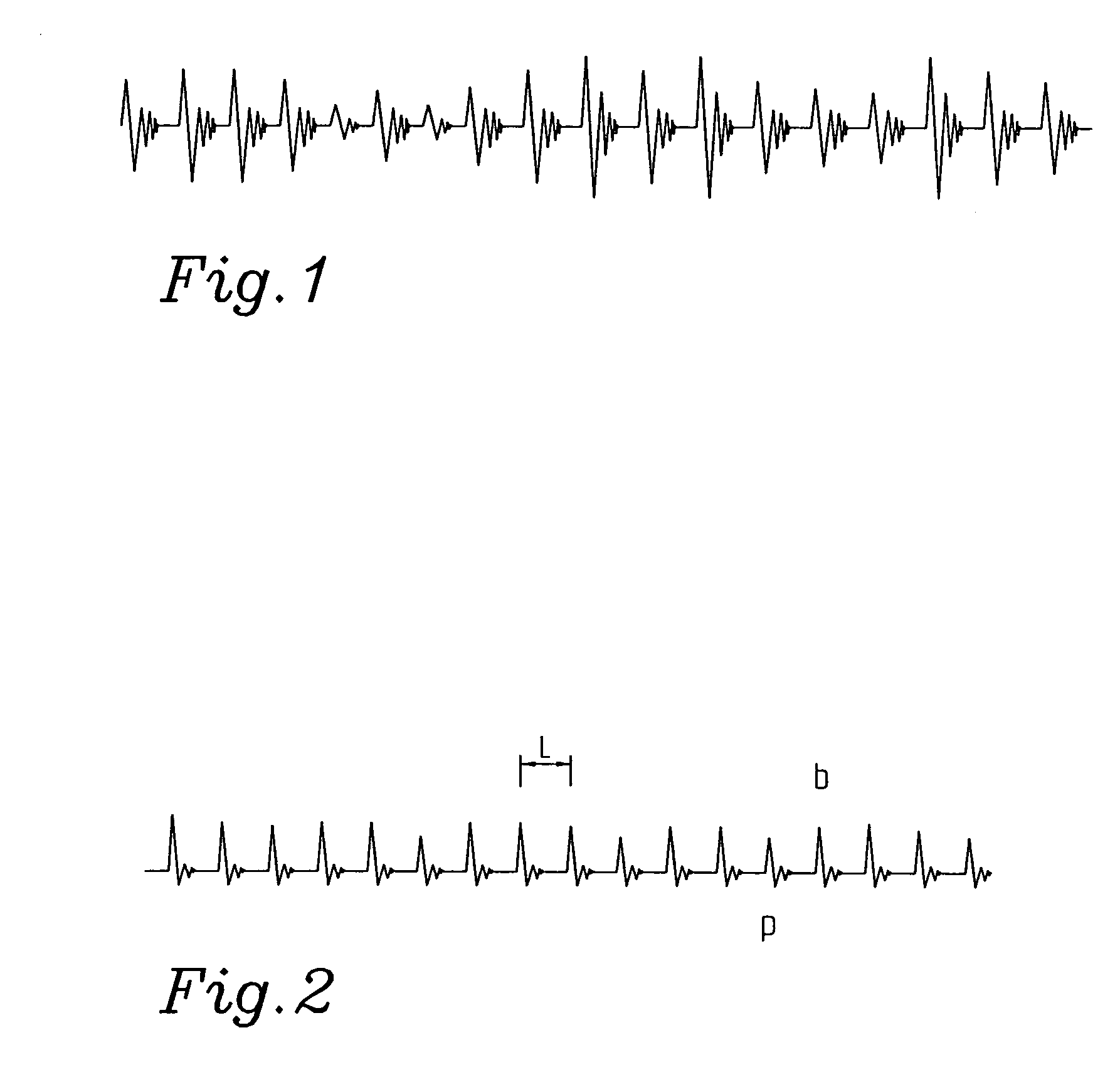 System for handling variations in the reception of a speech signal consisting of packets