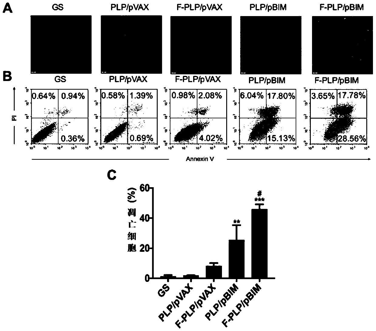 Folic acid modified liposome complex and preparation method and use thereof