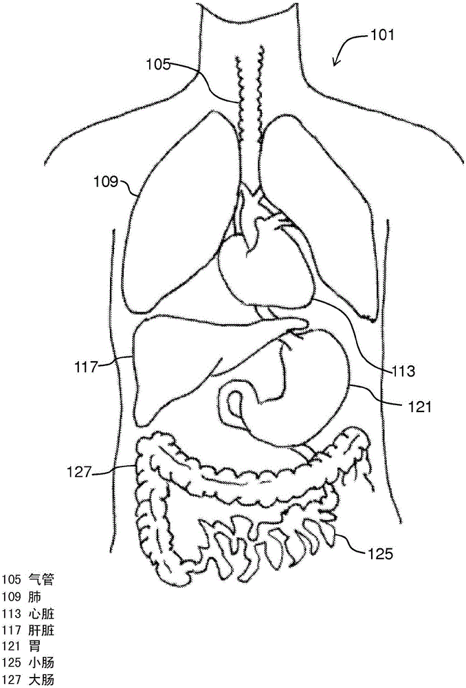 Devices and methods for intrahepatic shunts