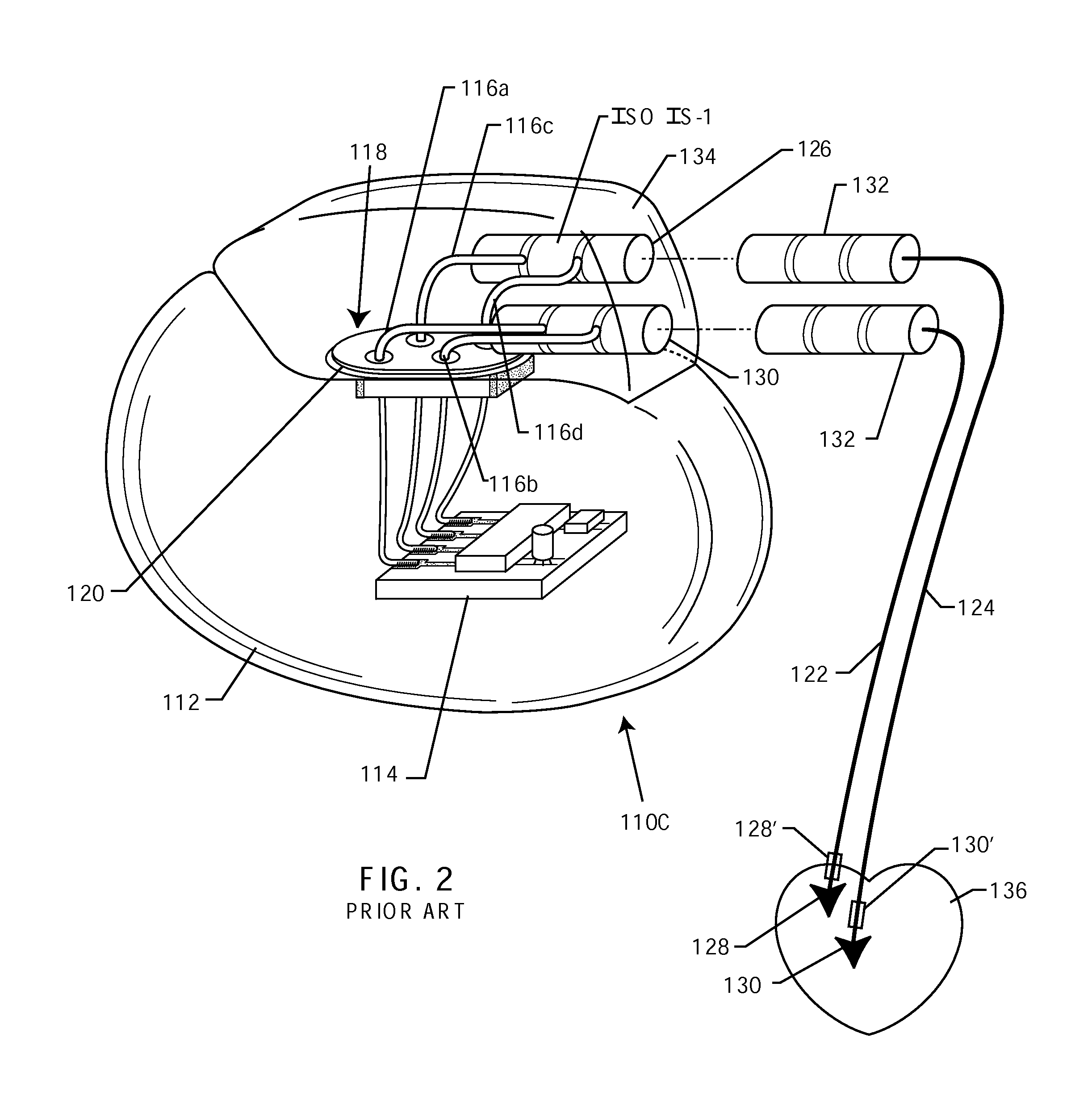Composite RF current attenuator for a medical lead