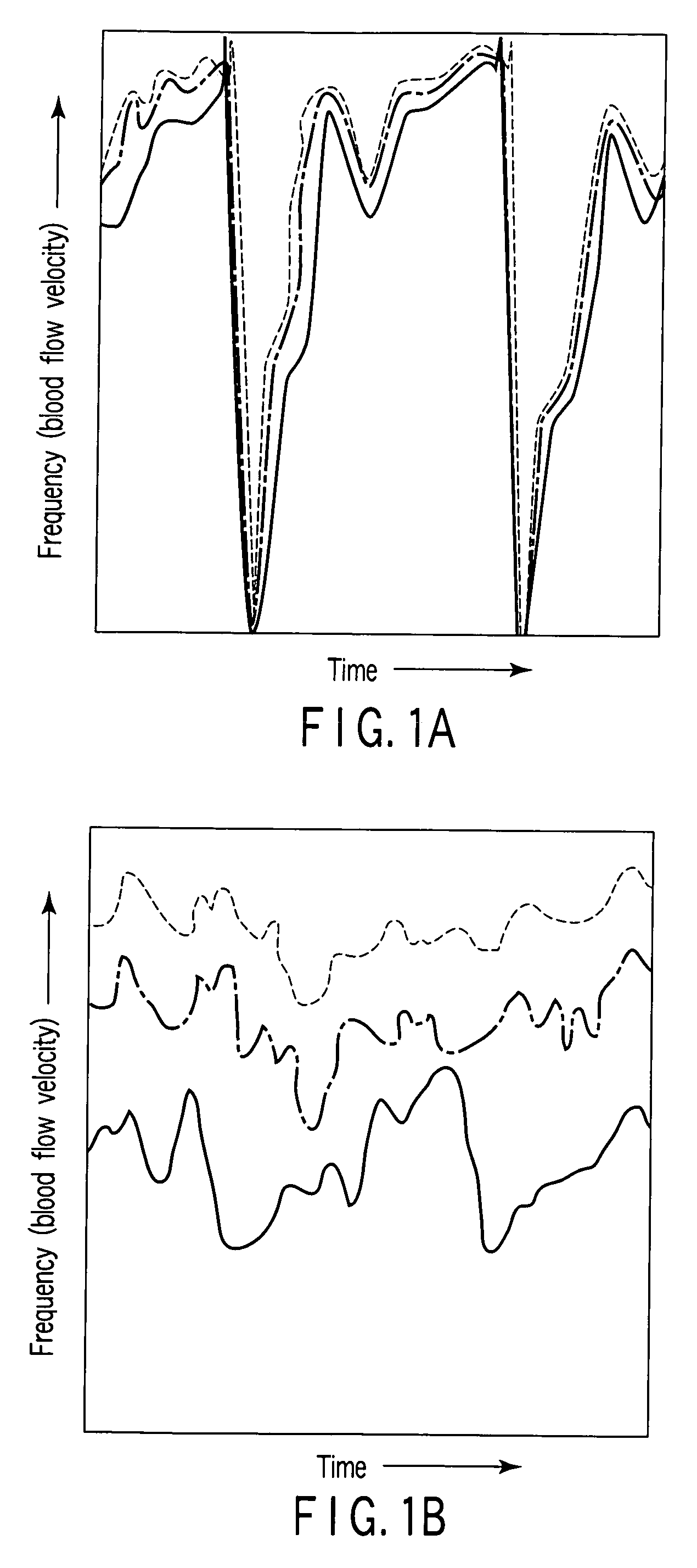 Ultrasonic doppler measuring apparatus and control method therefor