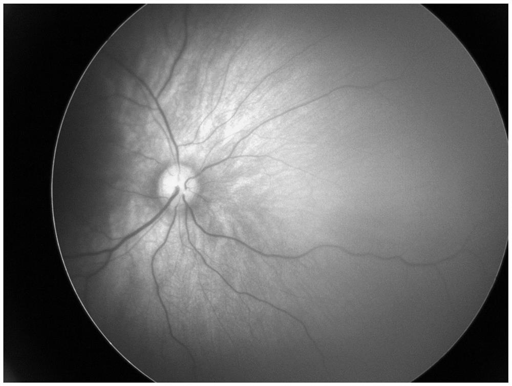 A fundus image stitching method based on deep neural network