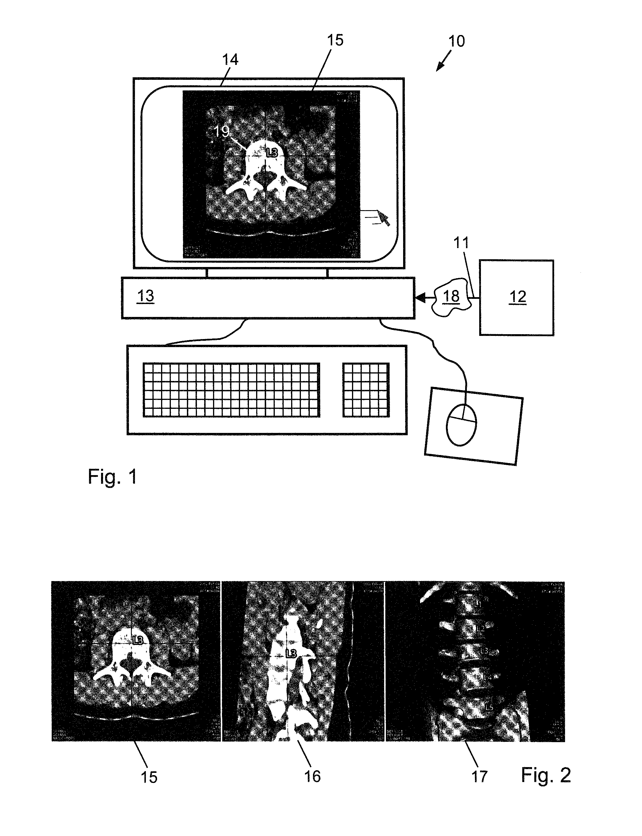 Method, apparatus and system for automated spine labeling