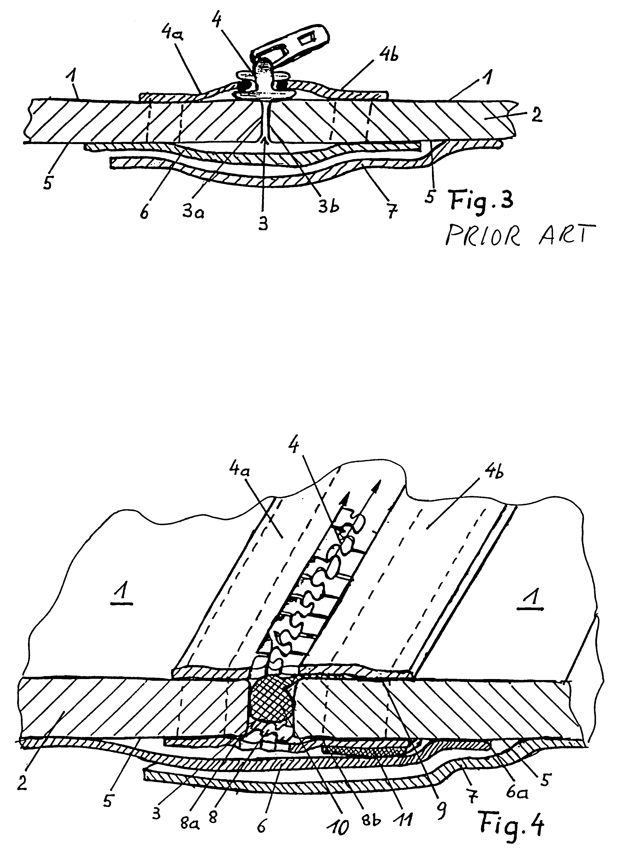 Closure device for slit opening of aquatic sport suit