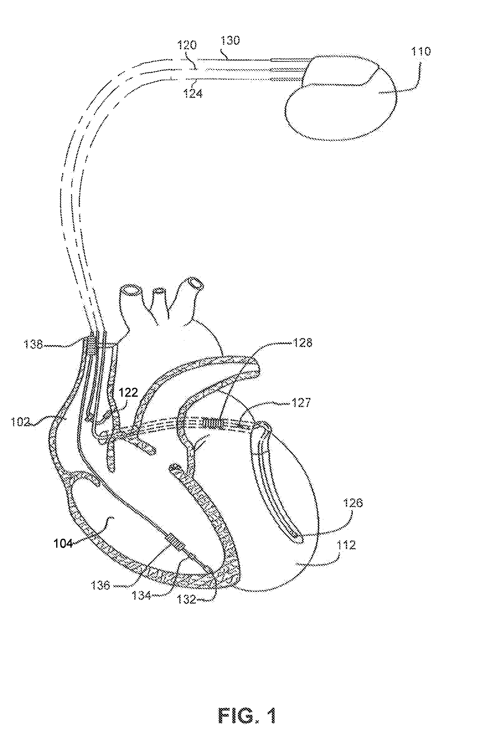 Method and Apparatus for Monitoring Arrythmogenic Effects of Medications Using an Implantable Device