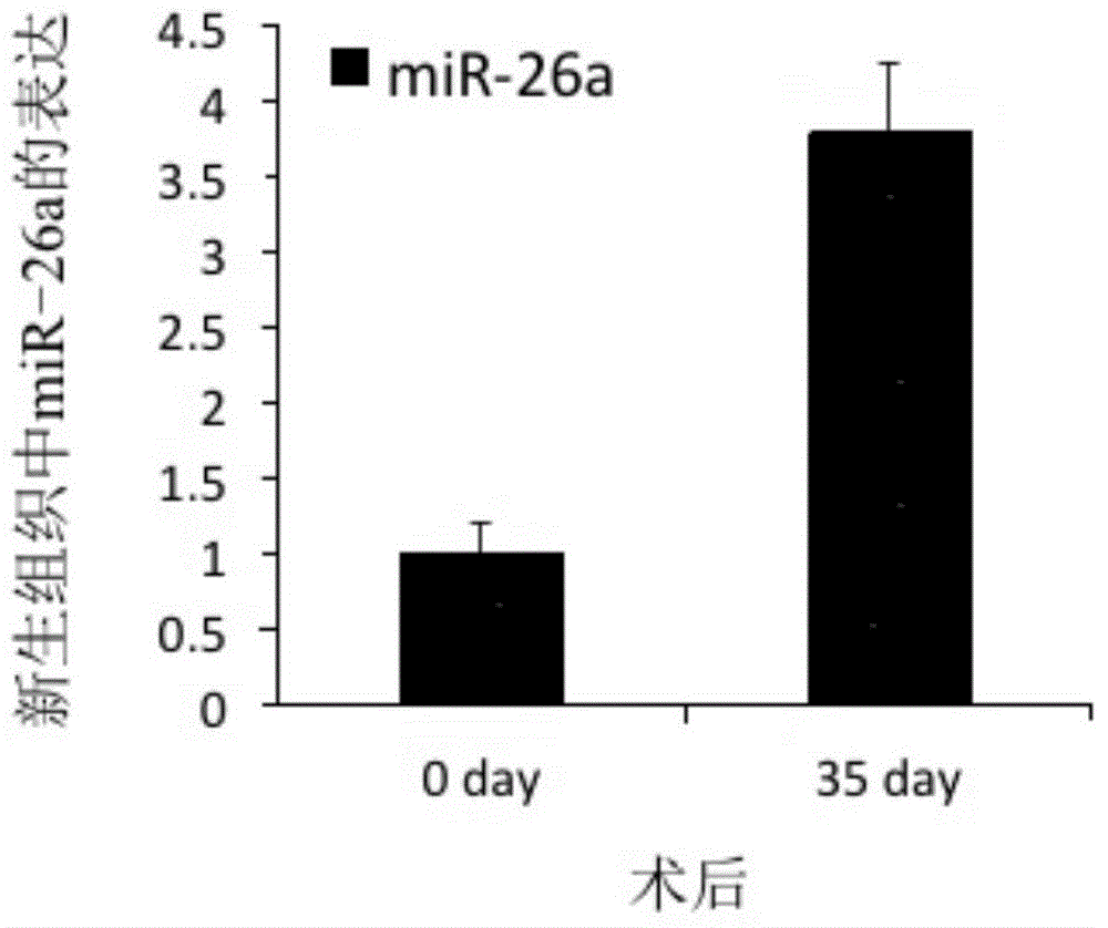 Micro RNA for accelerating tissue-engineered bone vascularization and application thereof