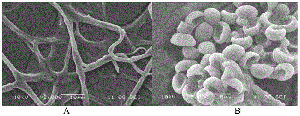 A strain of Trichoderma hacinata that utilizes cellobiose to produce β-glucosidase