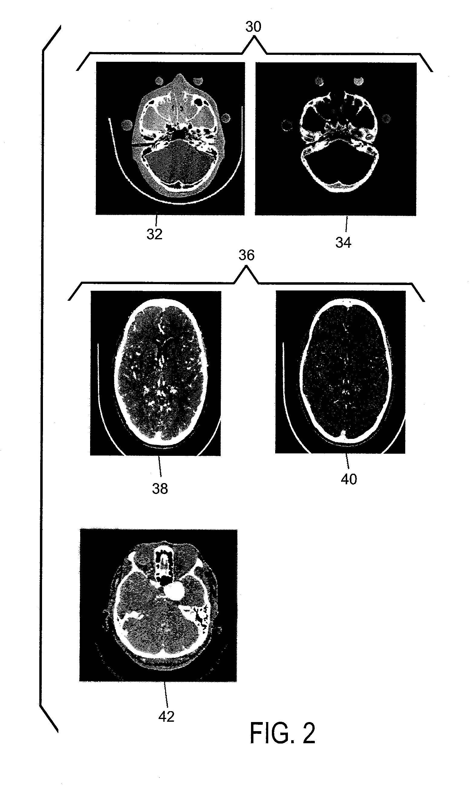 Computed tomography method and system