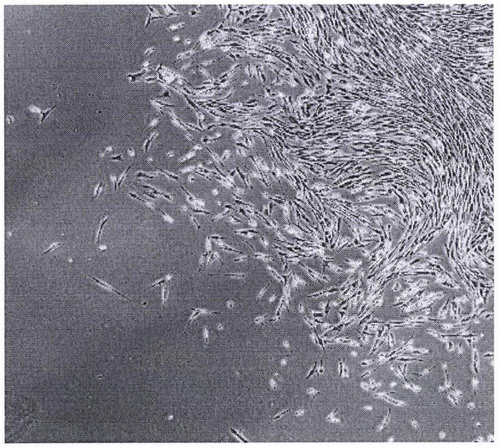 HACE2 knocked-out RNA interference stem cell vector novel coronavirus vaccine