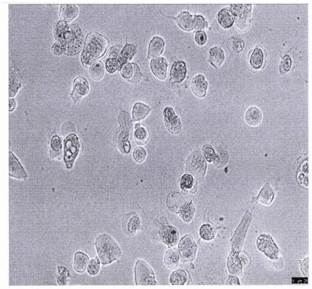 HACE2 knocked-out RNA interference stem cell vector novel coronavirus vaccine