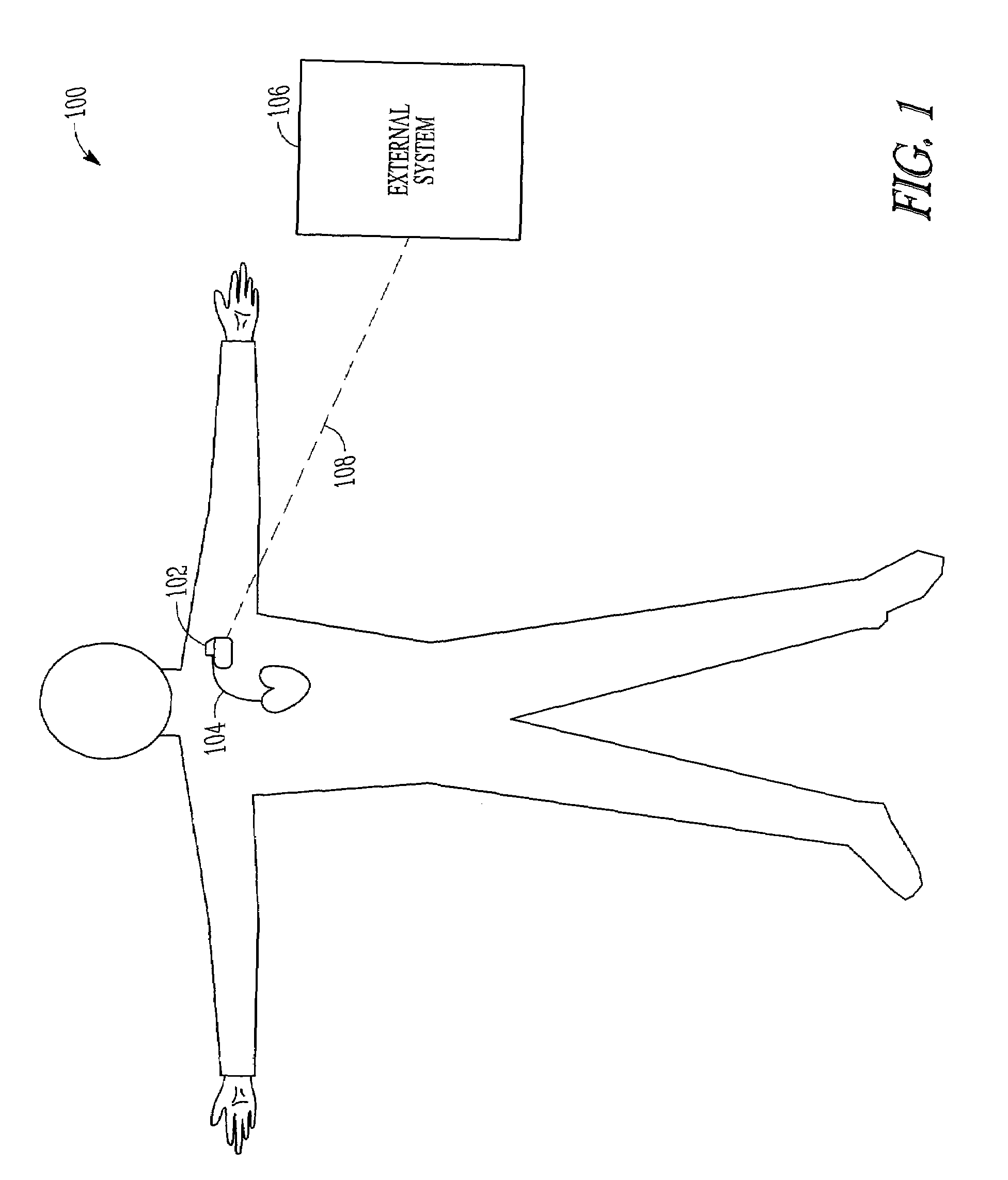 Physiological event detection systems and methods