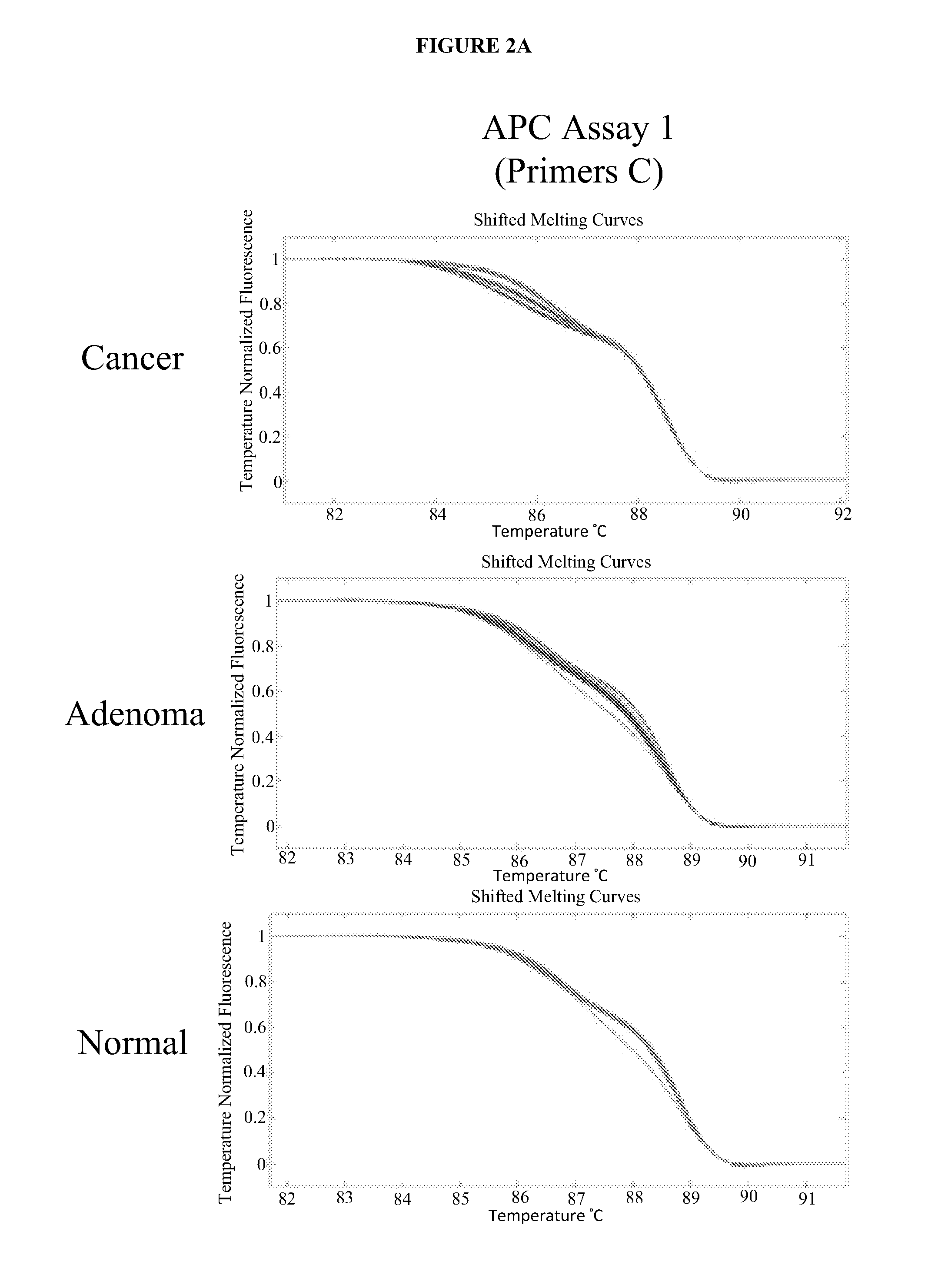 Methods and materials for detecting colorectal cancer and adenoma