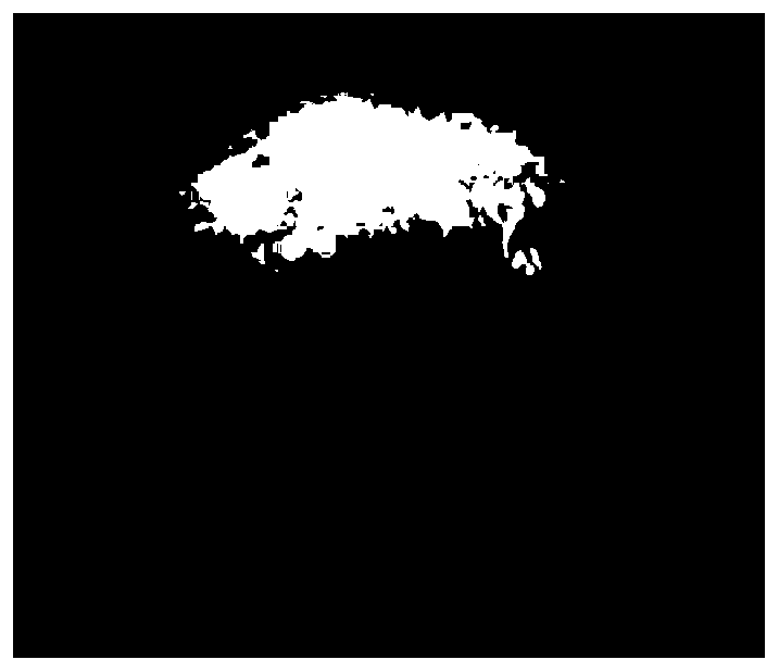 A small molecule marker of plasma metabolism related to cholelithiasis and its application