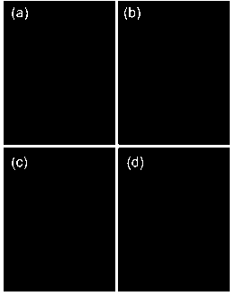 Synthesis method of lectin-iron core gold shell nanoparticles for tumor MRI/CT dual-mode diagnosis