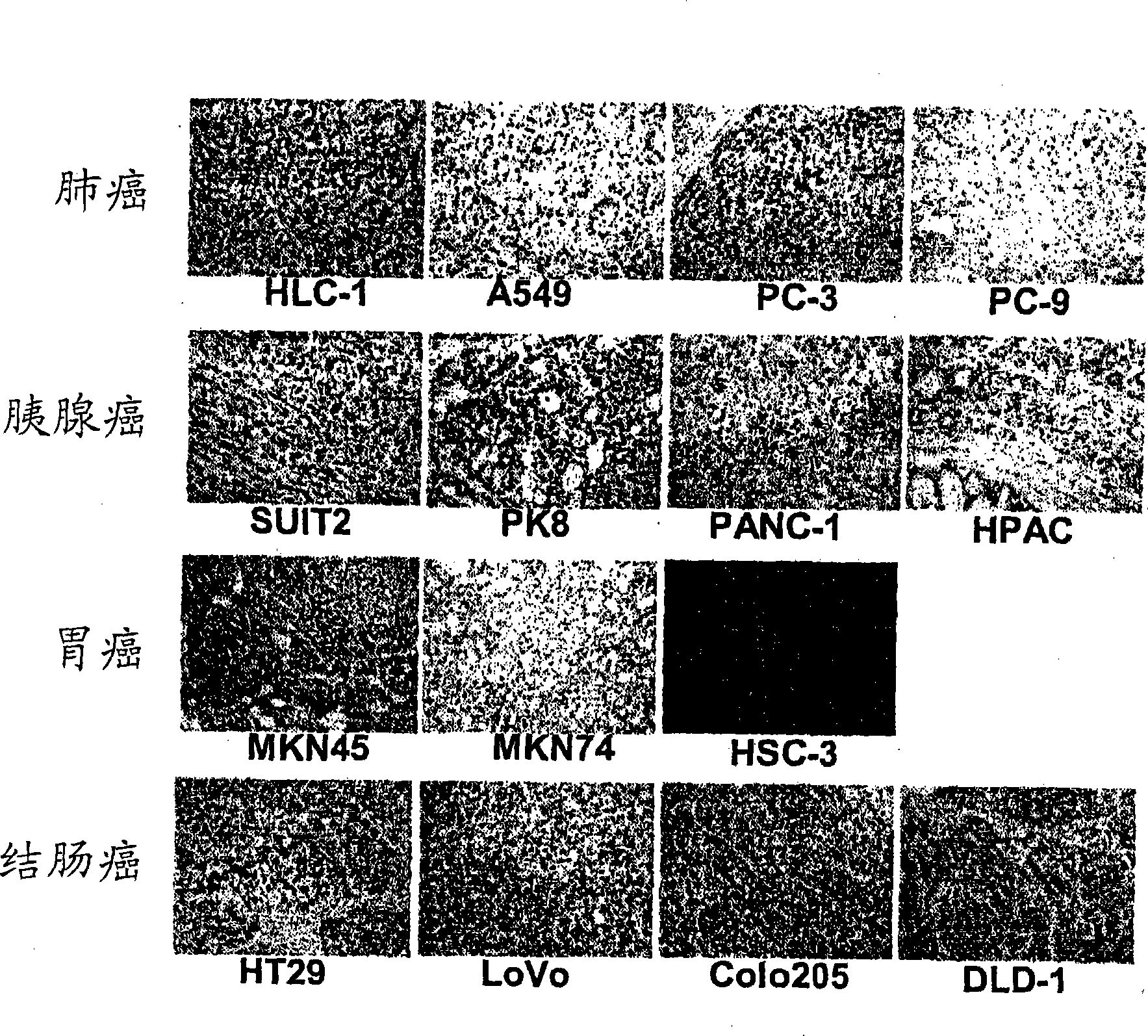 Monoclonal antibody, gene encoding the antibody, hybridoma, pharmaceutical composition, and diagnostic reagent