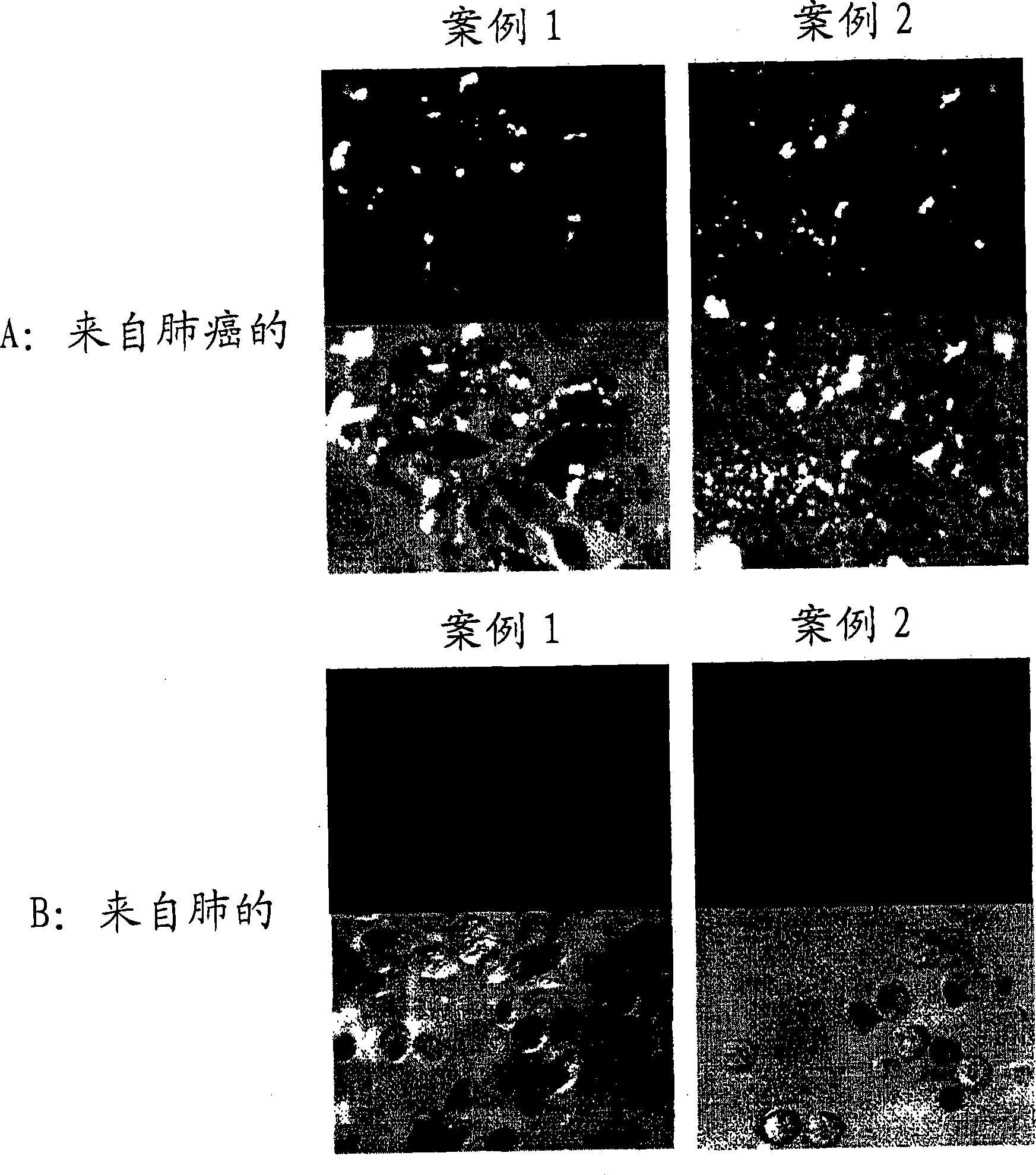 Monoclonal antibody, gene encoding the antibody, hybridoma, pharmaceutical composition, and diagnostic reagent