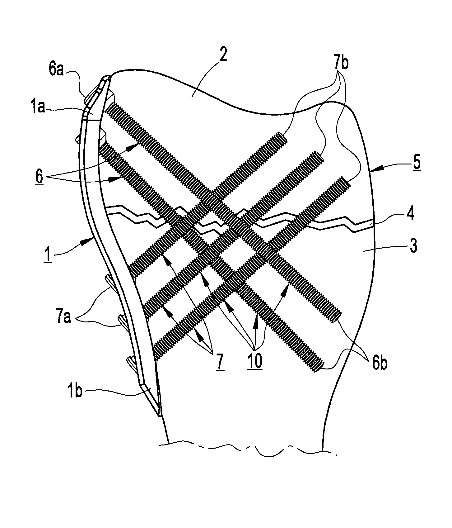 Device for internal fixation of the bone fragments in a radius fracture