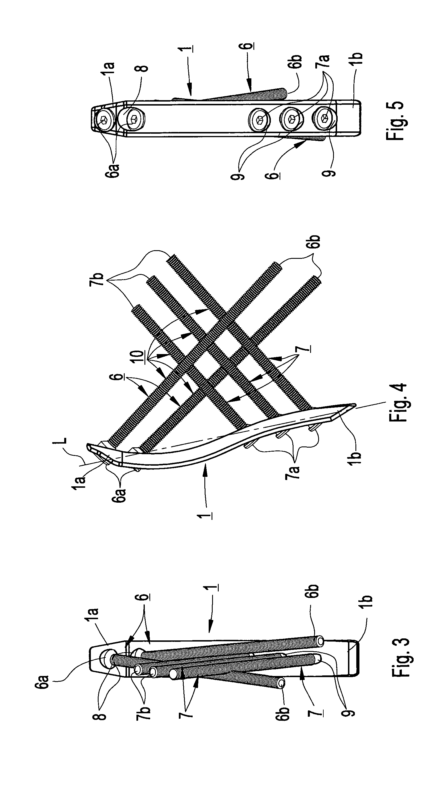 Device for internal fixation of the bone fragments in a radius fracture