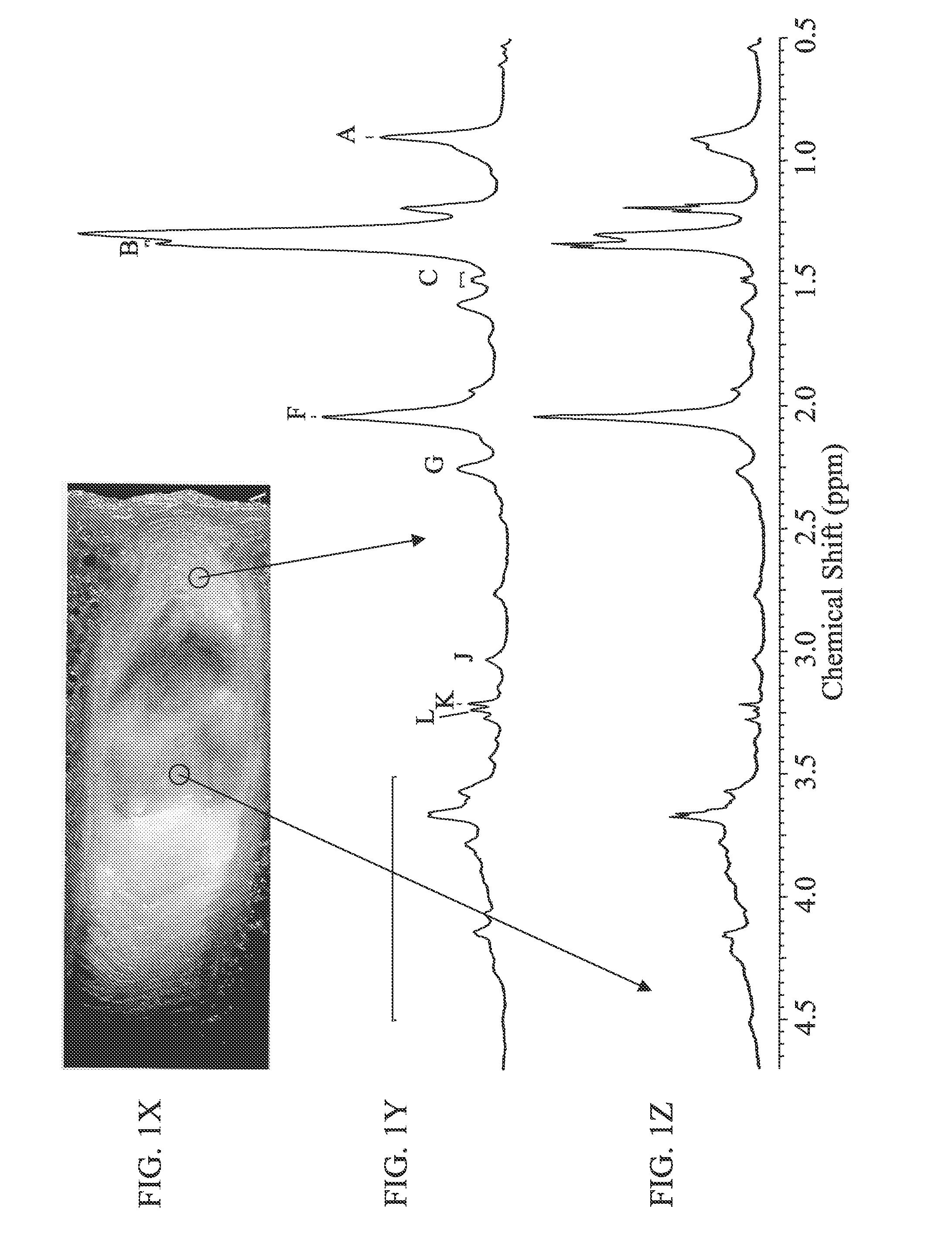 Systems and methods using nuclear magnetic resonance (NMR) spectroscopy to evaluate pain and degenerative properties of tissue