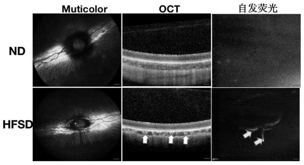 High-fat and high-sugar diet induced dry age-related macular degeneration pigment rabbit model