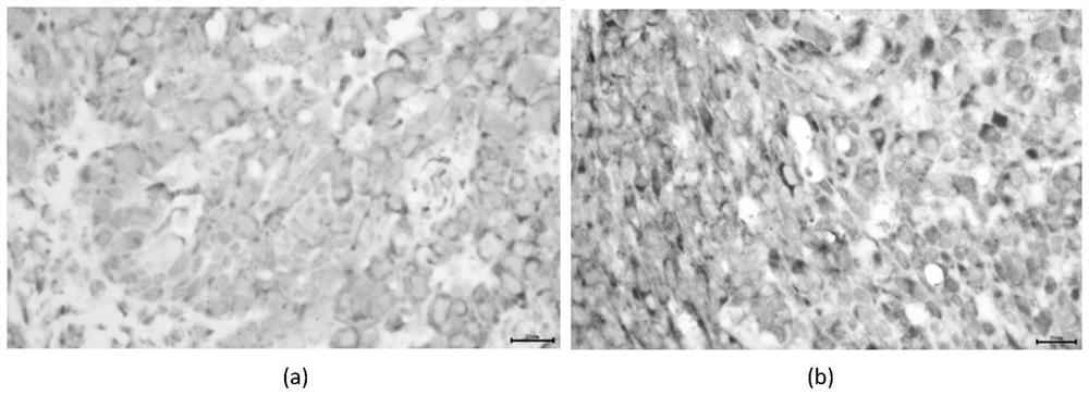 A prognostic diagnostic marker claudin21 for ovarian cancer and its application