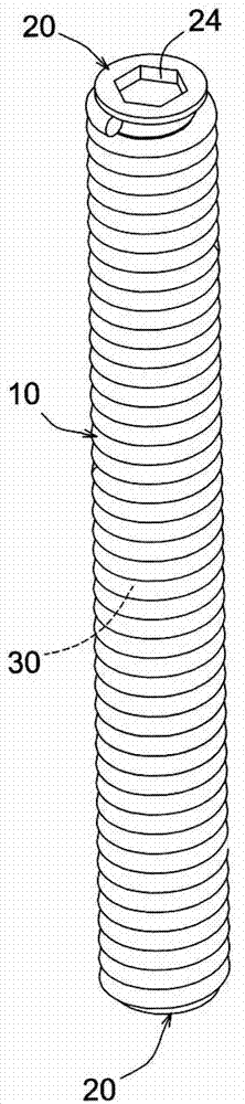 Anti-displacement coil spring-type spine stabilization device