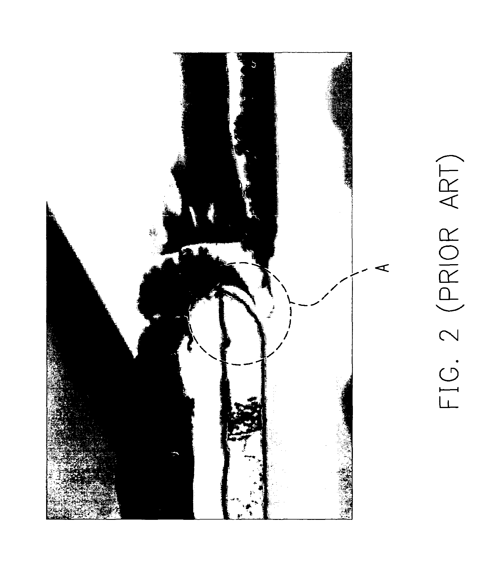 Thin film transistor array substrate and repairing method of the same