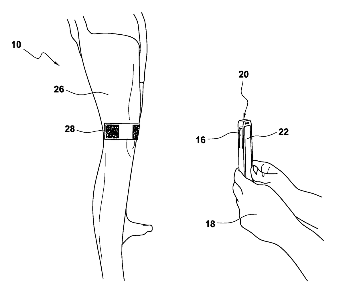 Measurement and ordering system for orthotic devices