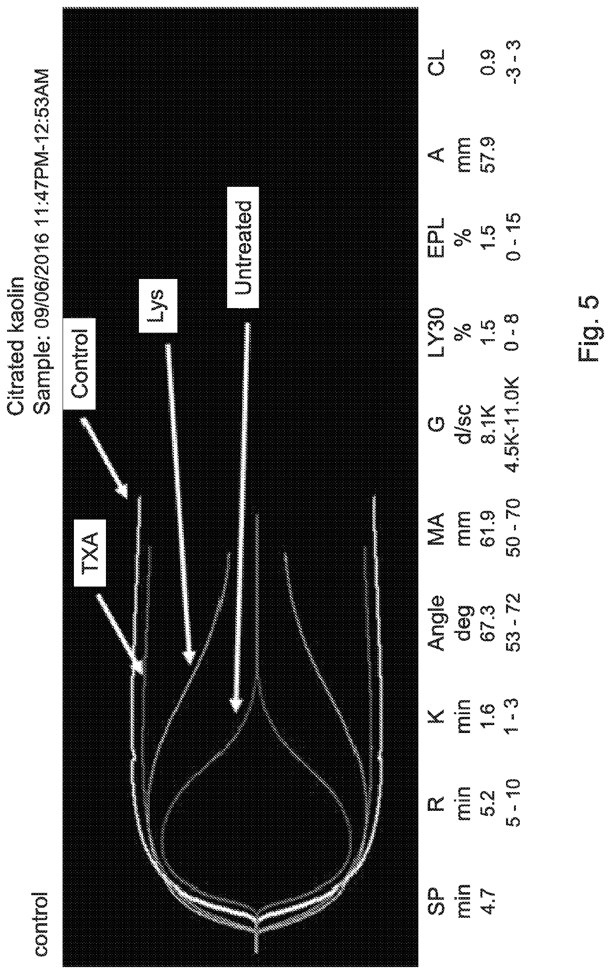 Human blood-derived products having decreased fibrinolytic activity and uses thereof in hemostatic disorders