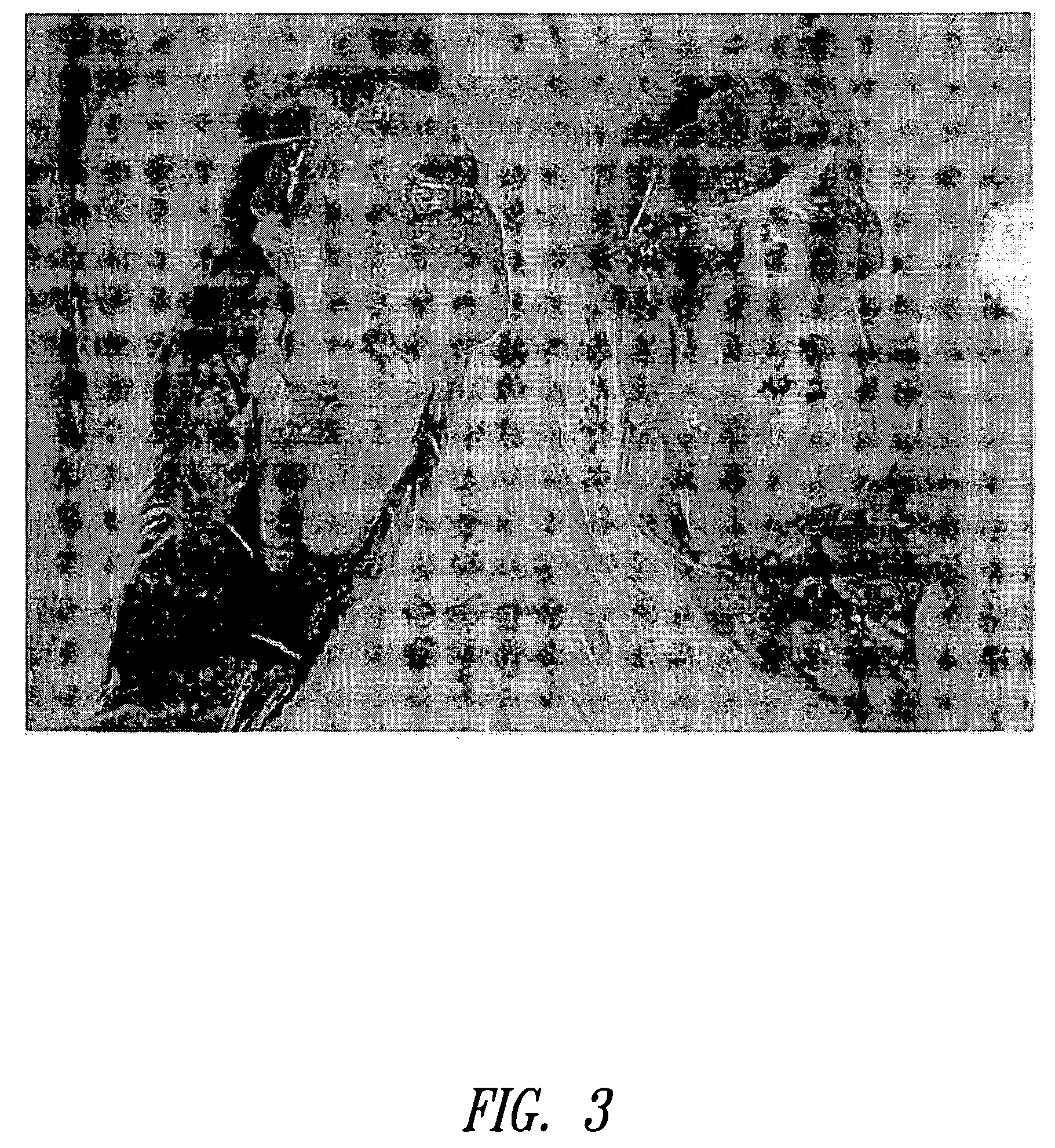 Compositions and methods for treating contracture