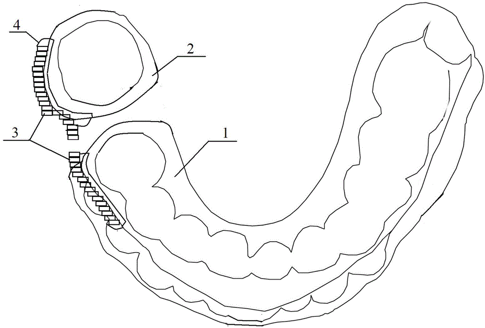 Movable oral appliance