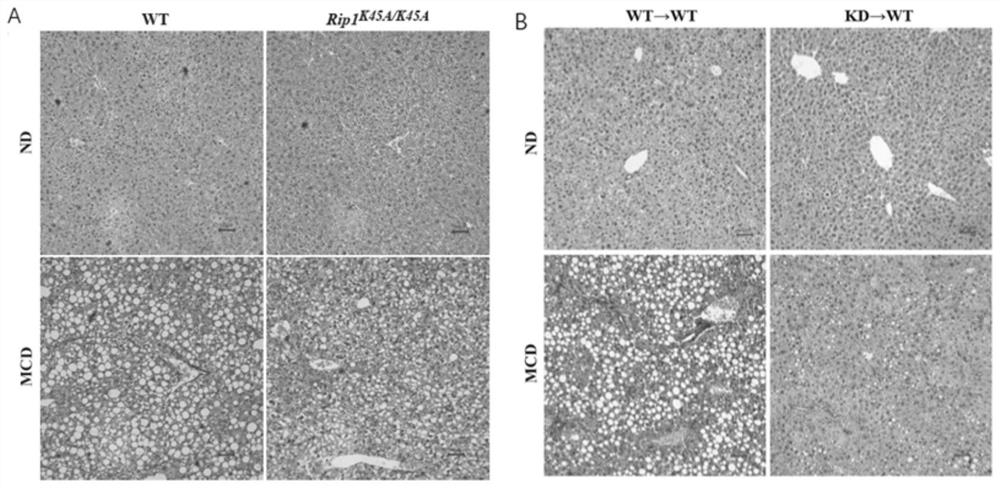 Application of macrophage-targeting RIPK1 and RIPK1 inhibitor in screening and preparing liver injury diagnosis and treatment medicine